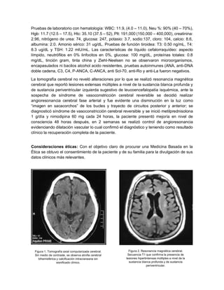 Pruebas de laboratorio con hematología: WBC: 11.9, (4.0 – 11.0), Neu %: 90% (40 – 70%),
Hgb: 11.7 (12.5 – 17.5), Htc: 35.10 (37.5 – 52), Plt: 191,000 (150,000 – 400,000), creatinina:
2.96, nitrógeno de urea: 74, glucosa: 247, potasio: 3.7, sodio:137, cloro: 104, calcio: 8.6,
albumina: 2.0. Amonio sérico: 31 ug/dL. Pruebas de función tiroidea: T3: 0.50 ng/mL, T4:
8.3 ug/dL y TSH: 1.22 mlU/mL. Las características de líquido cefalorraquídeo: aspecto
límpido, neutrófilos en 0% linfocitos en 0%, glucosa: 100 mg/dL, proteínas totales: 0.8
mg/dL, tinción gram, tinta china y Ziehl-Neelsen no se observaron microorganismos,
encapasulados ni bacilos alcohol acido resistentes, pruebas autoinmunes (ANA, anti-DNA
doble cadena, C3, C4, P-ANCA, C-ANCA, anti Scl-70, anti-Ro y anti-La fueron negativos.
La tomografía cerebral no reveló alteraciones por lo que se realizó resonancia magnética
cerebral que reportó lesiones extensas múltiples a nivel de la sustancia blanca profunda y
de sustancia periventricular izquierda sugestivo de leucoencefalopatía isquémica, ante la
sospecha de síndrome de vasoconstricción cerebral reversible se decidió realizar
angioresonancia cerebral fase arterial y fue evidente una disminución en la luz como
“imagen en sacacorchos” de los bucles y trayecto de circuitos posterior y anterior; se
diagnosticó síndrome de vasoconstricción cerebral reversible y se inició metilprednisolona
1 g/día y nimodipina 60 mg cada 24 horas, la paciente presentó mejoría en nivel de
consciencia 48 horas después, en 2 semanas se realizó control de angioresonancia
evidenciando dilatación vascular lo cual confirmó el diagnóstico y teniendo como resultado
clínico la recuperación completa de la paciente.
Consideraciones éticas: Con el objetivo claro de procurar una Medicina Basada en la
Ética se obtuvo el consentimiento de la paciente y de su familia para la divulgación de sus
datos clínicos más relevantes.
Figura 1. Tomografía axial computarizada cerebral.
Sin medio de contraste, se observa atrofia cerebral
bihemisférica y calcificación intracraneana sin
significado clínico.
Figura 2. Resonancia magnética cerebral.
Secuencia T1 que confirma la presencia de
lesiones hipertintensas múltiples a nivel de la
sustancia blanca profunda y de sustancia
periventricular.
 