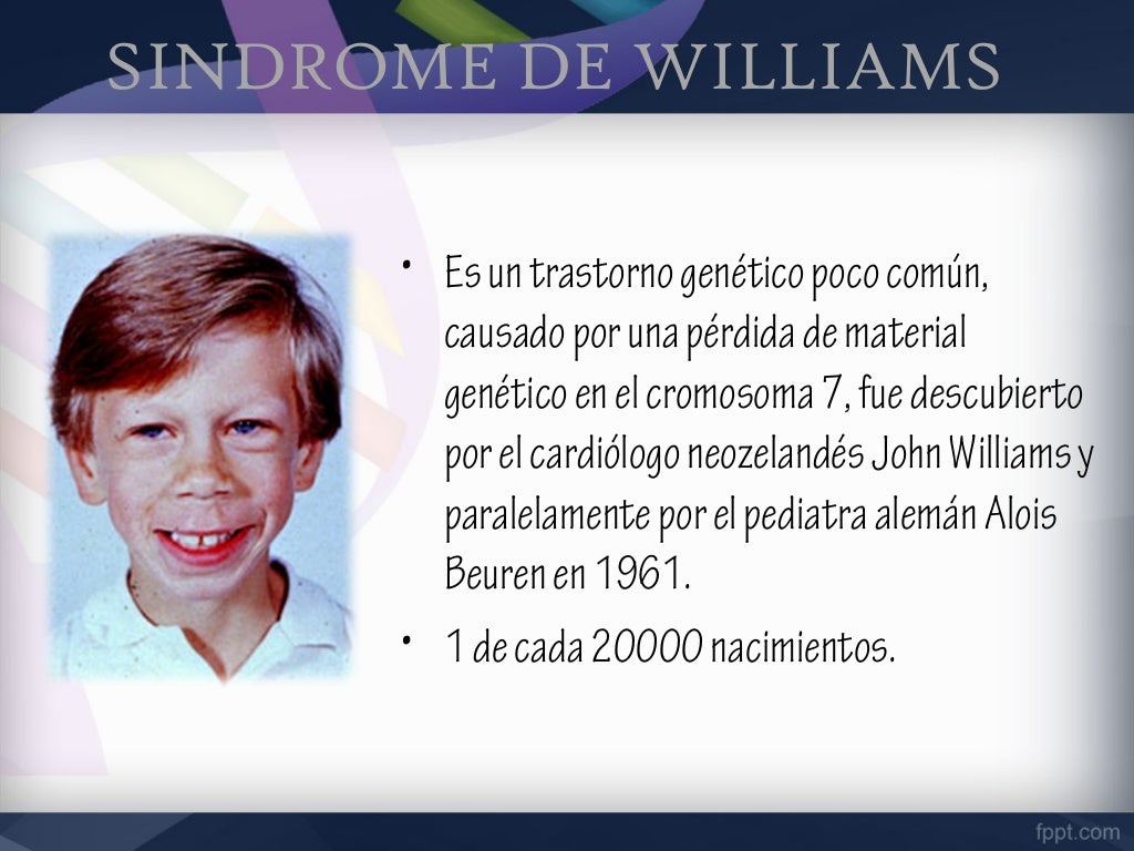 Sindrome de williams Sindrome de williams