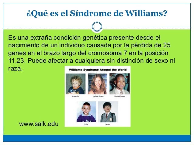 Caracteristicas Del Sindrome De Williams