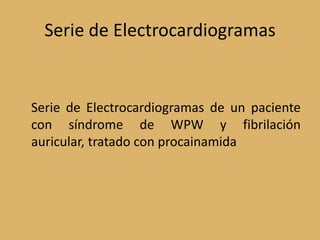 Serie de Electrocardiogramas	Serie de Electrocardiogramas de un paciente con síndrome de WPW y fibrilación auricular, tratado con procainamida