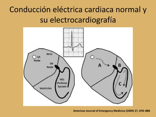 Conducción eléctrica cardiaca normal y su electrocardiografíaAmerican Journal of Emergency Medicine (2009) 27, 878–888