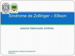 Síndrome de Zollinger – Ellison

            Jessica Valenzuela Jiménez




UNIVERSIDAD JUAREZ AUTONOMA DE
TABASCO
 