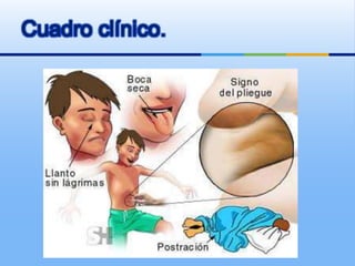 Cuadro clínico.
 
