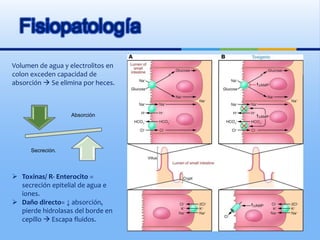 Fisiopatología
Volumen de agua y electrolitos en
colon exceden capacidad de
absorción  Se elimina por heces.
 Toxinas/ R- Enterocito =
secreción epitelial de agua e
iones.
 Daño directo= ↓ absorción,
pierde hidrolasas del borde en
cepillo  Escapa fluidos.
Absorción
Secreción.
 