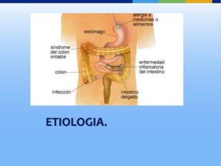 ETIOLOGIA.
 