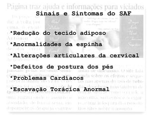 Sinais e Sintomas do SAF 
•Redução do tecido adiposo 
•Anormalidades da espinha 
•Alterações articulares da cervical 
•Defeitos de postura dos pés 
•Problemas Cardíacos 
•Escavação Torácica Anormal 
 