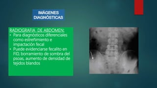 RADIOGRAFIA DE ABDOMEN:
• Para diagnósticos diferenciales
como estreñimiento e
impactación fecal
• Puede evidenciarse fecalito en
FID, borramiento de sombra del
psoas, aumento de densidad de
tejidos blandos
 
