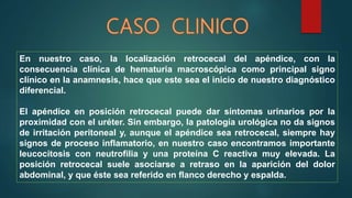 En nuestro caso, la localización retrocecal del apéndice, con la
consecuencia clínica de hematuria macroscópica como principal signo
clínico en la anamnesis, hace que este sea el inicio de nuestro diagnóstico
diferencial.
El apéndice en posición retrocecal puede dar síntomas urinarios por la
proximidad con el uréter. Sin embargo, la patología urológica no da signos
de irritación peritoneal y, aunque el apéndice sea retrocecal, siempre hay
signos de proceso inflamatorio, en nuestro caso encontramos importante
leucocitosis con neutrofilia y una proteína C reactiva muy elevada. La
posición retrocecal suele asociarse a retraso en la aparición del dolor
abdominal, y que éste sea referido en flanco derecho y espalda.
 