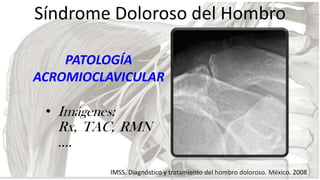 Síndrome Doloroso del Hombro
PATOLOGÍA
ACROMIOCLAVICULAR
• Imágenes:

Rx, TAC, RMN
….
IMSS. Diagnóstico y tratamiento del ...