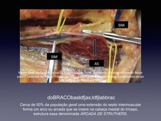 Nervo ulnar perfurando o septo intermuscular (SIM), passando do compartimento flexor
para o extensor do braço. Fibras da cabeça medial do músculo tríceps conectando-se ao
SIM, arcada de Struthers (AS).
doBRACObasldfjas;ldfjlabbrac
Cerca de 50% da população geral uma extensão do septo intermuscular
forma um arco ou arcada que se insere na cabeça medial do tríceps,
estrutura essa denominada ARCADA DE STRUTHERS.
 
