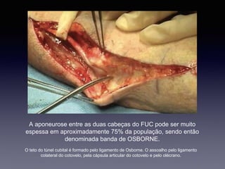 A aponeurose entre as duas cabeças do FUC pode ser muito
espessa em aproximadamente 75% da população, sendo então
denominada banda de OSBORNE.
O teto do túnel cubital é formado pelo ligamento de Osborne. O assoalho pelo ligamento
colateral do cotovelo, pela cápsula articular do cotovelo e pelo olécrano.
 