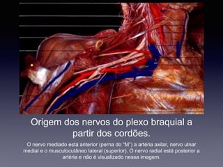 Origem dos nervos do plexo braquial a
partir dos cordões.
O nervo mediado está anterior (perna do “M”) a artéria axilar, nervo ulnar
medial e o musculocutâneo lateral (superior). O nervo radial está posterior a
artéria e não é visualizado nessa imagem.
 
