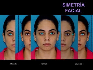 Derecho   Normal   Izquierdo
 