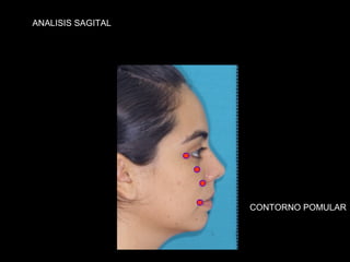 ANALISIS SAGITAL




                   CONTORNO POMULAR
 