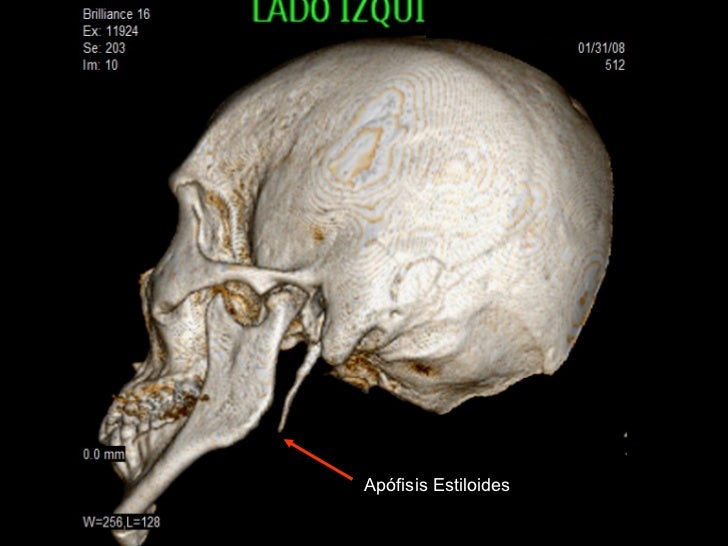 Si Può Convivere Con La Sindrome Di Eagle