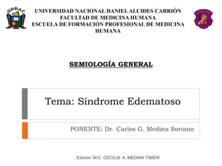 Tema: Síndrome Edematoso
PONENTE: Dr. Carlos G. Medina Soriano
SEMIOLOGÍA GENERAL
Edición: M.C. CECILIA A. MEDINA TÁBER
UNIVERSIDAD NACIONAL DANIELALCIDES CARRIÓN
FACULTAD DE MEDICINA HUMANA
ESCUELA DE FORMACIÓN PROFESIONAL DE MEDICINA
HUMANA
 