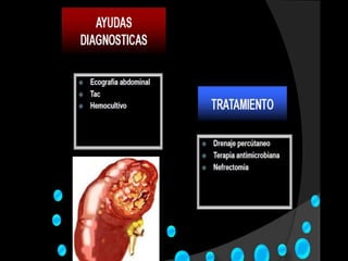 Haemophylus influenzae
 