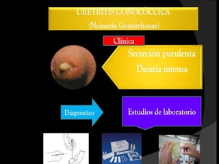 peso del bebé supere
       los 2kg
 