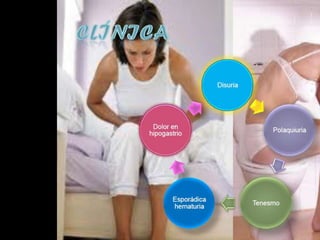 Es la
Hepatitis    irritación e
              hinchazón
   B        (inflamación)
              del hígado
 