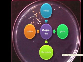 Una dosis de DPT contiene 20 Lf de Toxoide
  Diftérico, 10 Lf de Toxoide Tetánico y 16
 Unidades Opalescentes de bacilos muertos
 (célula completa de Bordetella pertussis)
inactivados con formol e integrados en una
                 suspensión.
 