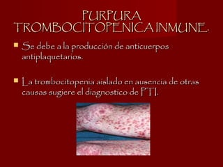 PURPURAPURPURA
TROMBOCITOPENICA INMUNE.TROMBOCITOPENICA INMUNE.
 Se debe a la producción de anticuerposSe debe a la producción de anticuerpos
antiplaquetarios.antiplaquetarios.
 La trombocitopenia aislado en ausencia de otrasLa trombocitopenia aislado en ausencia de otras
causas sugiere el diagnostico de PTI.causas sugiere el diagnostico de PTI.
 