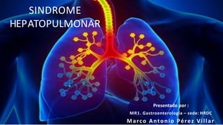 SINDROME
HEPATOPULMONAR
Presentado por :
MR1. Gastroenterología – sede: HRDC
Marco Antonio Pérez Villar
 
