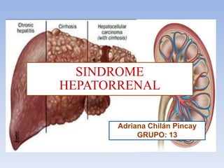 Síndrome Hepatorrenal
SINDROME
HEPATORRENAL
Adriana Chilán Pincay
GRUPO: 13

 