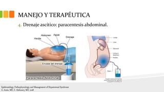 MANEJO Y TERAPÉUTICA
4. Drenaje ascítico: paracentesis abdominal.
 