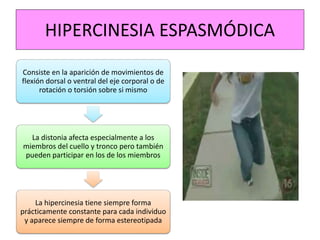 HIPERCINESIA ESPASMÓDICA
Consiste en la aparición de movimientos de
flexión dorsal o ventral del eje corporal o de
rotación o torsión sobre si mismo
La distonia afecta especialmente a los
miembros del cuello y tronco pero también
pueden participar en los de los miembros
La hipercinesia tiene siempre forma
prácticamente constante para cada individuo
y aparece siempre de forma estereotipada
 
