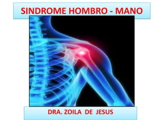 SINDROME HOMBRO - MANO




    DRA. ZOILA DE JESUS
 