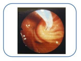 La acción de la enzima puede potenciarse con fenobarbitalSxgilbert