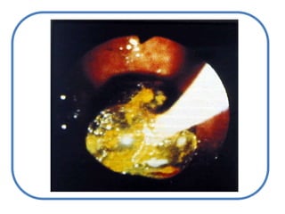 Estudio del pacienteictéricoCLÍNICOINTERROGATORIO