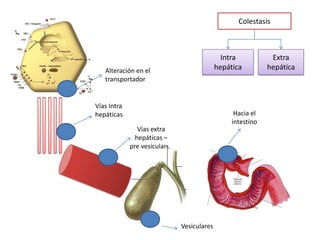 -  ESTÁ UNIDA A ALBUMINA.