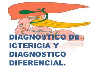 DIAGNOSTICO DE
ICTERICIA Y
DIAGNOSTICO
DIFERENCIAL.
 