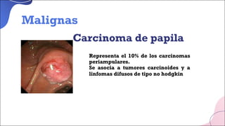 Carcinoma de papila
■ Representa el 10% de los carcinomas
periampulares.
■ Se asocia a tumores carcinoides y a
linfomas difusos de tipo no hodgkin
Malignas
 
