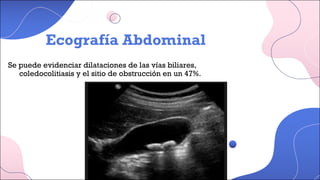 Se puede evidenciar dilataciones de las vías biliares,
coledocolitiasis y el sitio de obstrucción en un 47%.
Ecografía Abdominal
Ecografía Abdominal
 