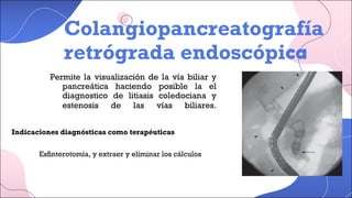 Colangiopancreatografía
retrógrada endoscópica
Permite la visualización de la vía biliar y
pancreática haciendo posible la el
diagnostico de litiasis coledociana y
estenosis de las vías biliares.
Indicaciones diagnósticas como terapéuticas
Esfinterotomía, y extraer y eliminar los cálculos
 