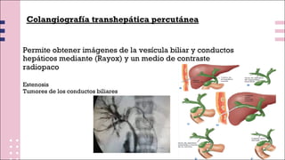 Colangiografía transhepática percutánea
Permite obtener imágenes de la vesícula biliar y conductos
hepáticos mediante (Rayox) y un medio de contraste
radiopaco
Estenosis
Tumores de los conductos biliares
 