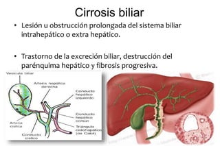 Cirrosis biliar 
• Lesión u obstrucción prolongada del sistema biliar 
intrahepático o extra hepático. 
• Trastorno de la excreción biliar, destrucción del 
parénquima hepático y fibrosis progresiva. 
 
