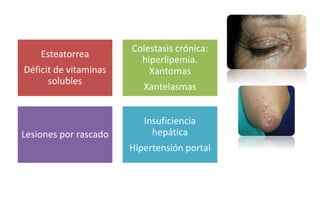 Esteatorrea 
Déficit de vitaminas 
solubles 
Colestasis crónica: 
hiperlipemia. 
Xantomas 
Xantelasmas 
Lesiones por rascado 
Insuficiencia 
hepática 
Hipertensión portal 
 