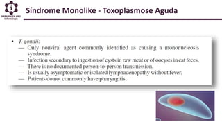 Síndrome Monolike - Toxoplasmose Aguda
 