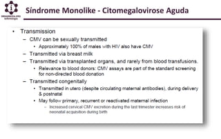 Síndrome Monolike - Citomegalovirose Aguda
 