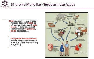 Síndrome Monolike - Toxoplasmose Aguda
 