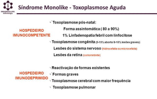Síndrome Monolike - Toxoplasmose Aguda
 
