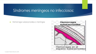 Síndromes meníngeos no infecciosos:
 Hemorragia subaracnoidea o meníngea
Cundapí Toledo Marcela Lizeth
 