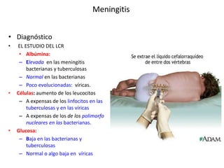 SINDROME MENINGEO RODRIGO QUIROZ.pptx
