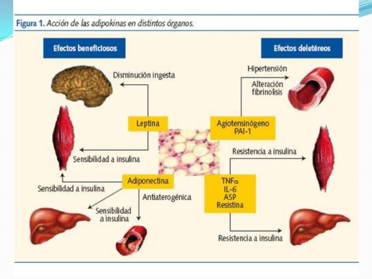 Sindrome metabólico Sindrome metabólico