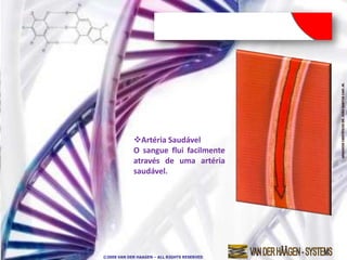 Artéria Saudável
            O sangue flui facilmente
            através de uma artéria
            saudável.




©2009 VAN DER HAAGEN – ALL RIGHTS RESERVED
 