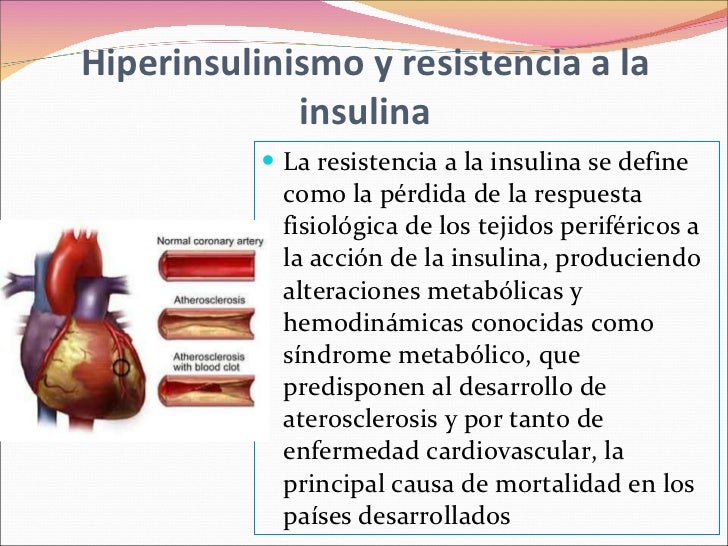 Sindrome metabolico pediatria Sindrome metabolico pediatria