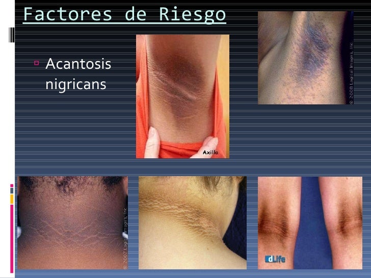 Sindrome metabolico perú Sindrome metabolico perú
